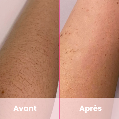 LumiSkin Pro | La solution ultime pour une peau lisse et sans poils